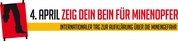 Banner: Zeig dein Bein